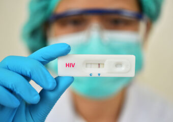 Aids não é a mesma coisa que HIV! Saiba tudo sobre a Síndrome da Imunodeficiência Adquirida