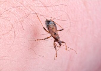 O que é a doença de Chagas e como ela é transmitida?